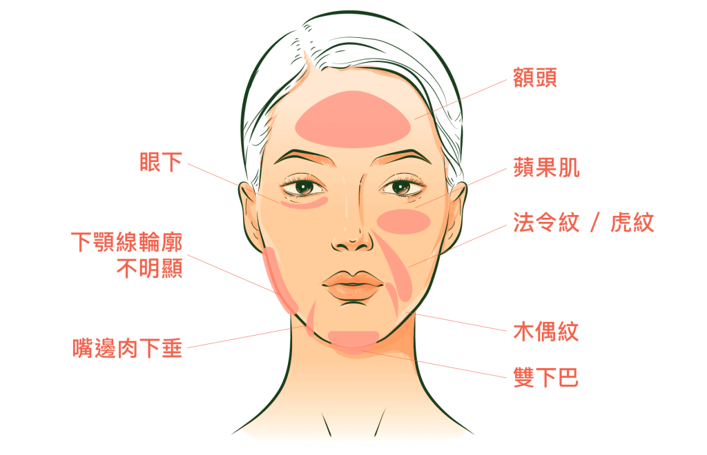 面部肌膚問題示意圖，標註各個部位如眼下、法令紋、雙下巴等，幫助了解常見的皮膚衰老問題。