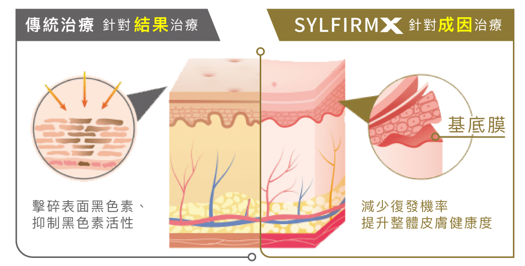 比較傳統治療與SYLFIRM X治療的效果，展示如何減少黑色素及提升皮膚健康，強調SYLFIRM X技術的優勢。